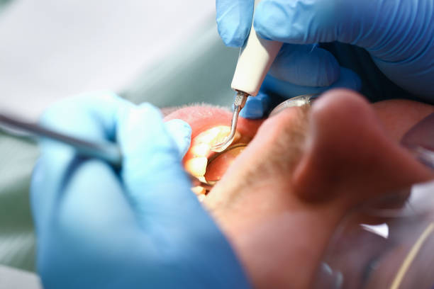 Best Emergency Dental Surgery in Montague, CA