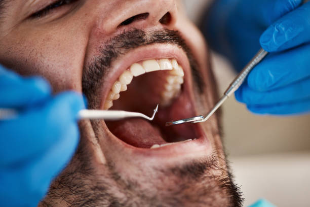 Best Emergency Tooth Extraction in Montague, CA