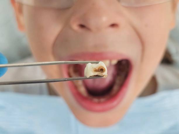 Best Same-Day Emergency Dentist in Montague, CA