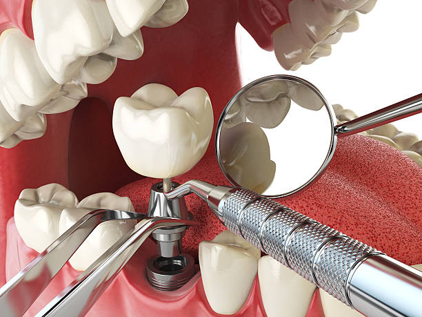 Best Emergency Treatment for Toothache in Montague, CA